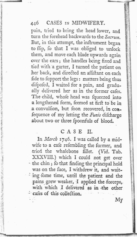 A Collection of Cases and Observations in Midwifery (Volume Two) Page 446. Choose 'View Text' (at top) for faster download.