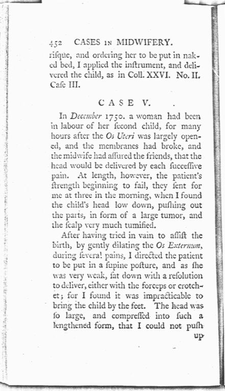 A Collection of Cases and Observations in Midwifery (Volume Two) Page 452. Choose 'View Text' (at top) for faster download.